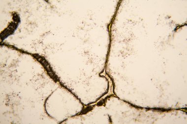 Mikroskobik görünümü ve çürük Lale kök detaylarını 