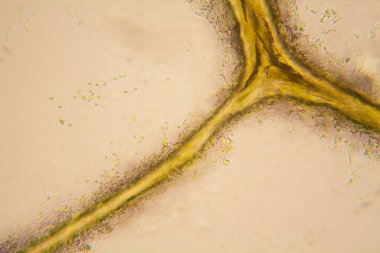 Mikroskobik görünümü ve çürük Lale kök detaylarını 