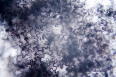 Mikroskobik görünümü ve çürük Lale kök detaylarını 