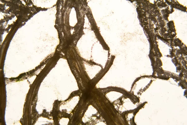 Mikroskobik görünümü ve çürük Lale kök detaylarını 