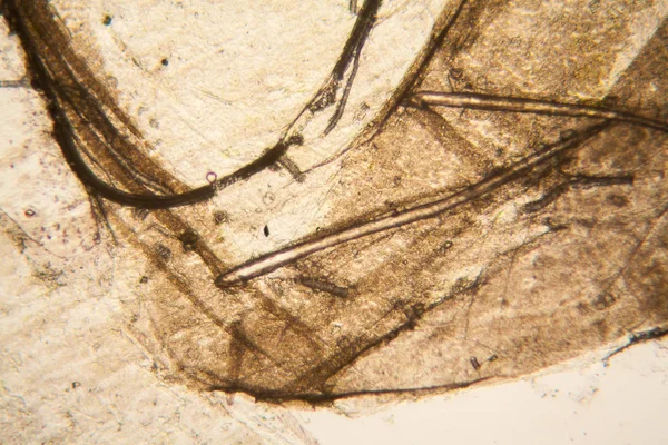 Microscopic View Details Rotten Tulip Stem — Stock Photo, Image
