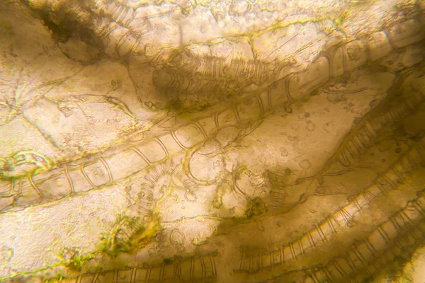 Mikroskobik görünümü ve çürük Lale kök detaylarını 