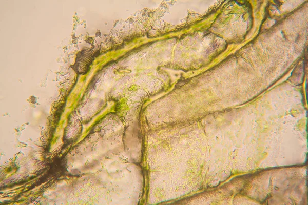 Obraz Mikroskopowy Szczegóły Zgniłe Tulipan Łodygi — Zdjęcie stockowe