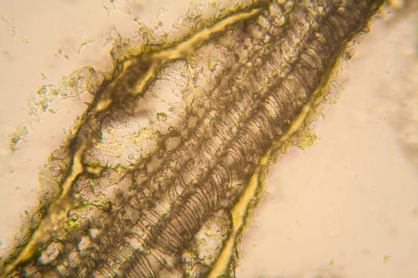 Microscopic View Details Rotten Tulip Stem — Stock Photo, Image