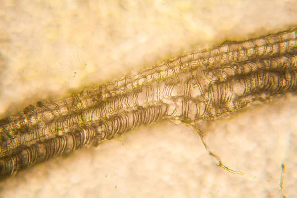 Mikroskobik görünümü ve çürük Lale kök detaylarını 