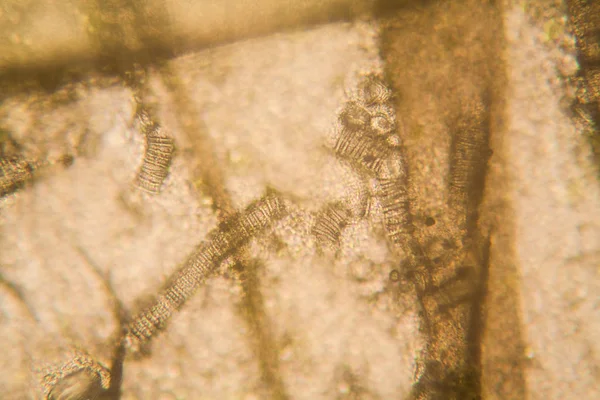 腐烂郁金香茎的显微观察和细节 — 图库照片