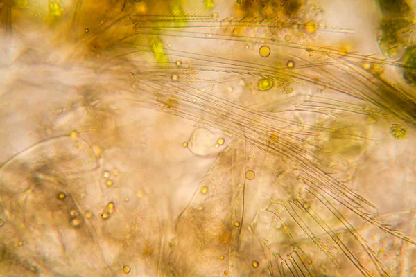 Fresh Pond Water Plankton Algae Microscope Dead Copepod Details — Stock Photo, Image