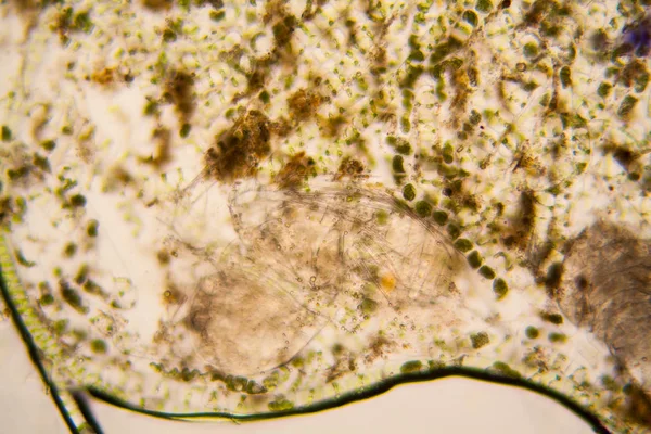 Taze su birikintisi su planktonları ve yosun, mikroskop. Ölü copepod 