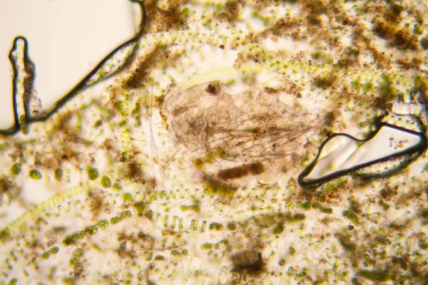 Taze su birikintisi su planktonları ve yosun, mikroskop. Ölü copepod 