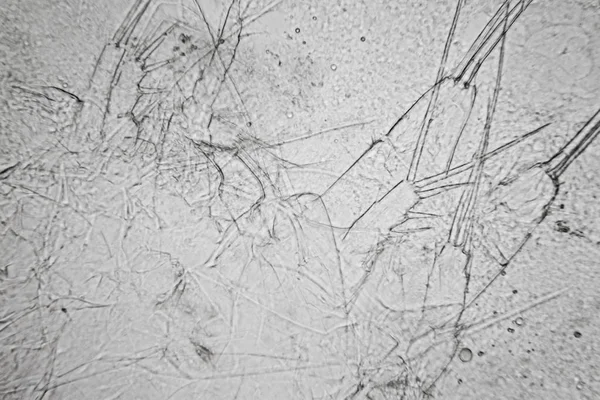 Plankton Air Kolam Segar Dan Ganggang Mikroskop Rincian Mati Copepod — Stok Foto