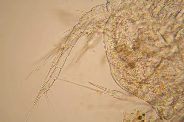 Fresh Pond Water Plankton Algae Microscope Dead Copepod Details — Stock Photo, Image