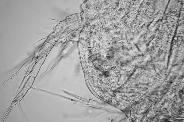 Plancton Agua Dulce Algas Microscopio Detalles Del Copépodo Muerto —  Fotos de Stock
