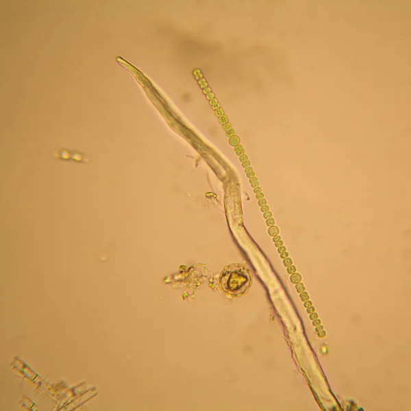 Plancton Eau Douce Étang Algues Microscope Nostoc Commune — Photo