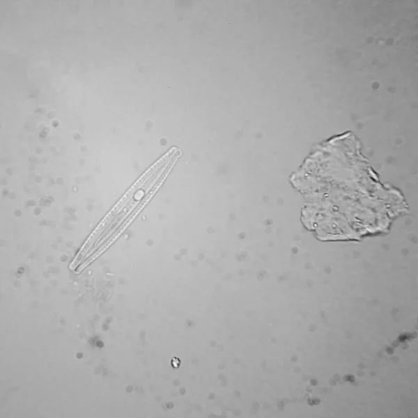 Taze Birikintisi Planktonları Yosun Mikroskop Diyatomlarla — Stok fotoğraf