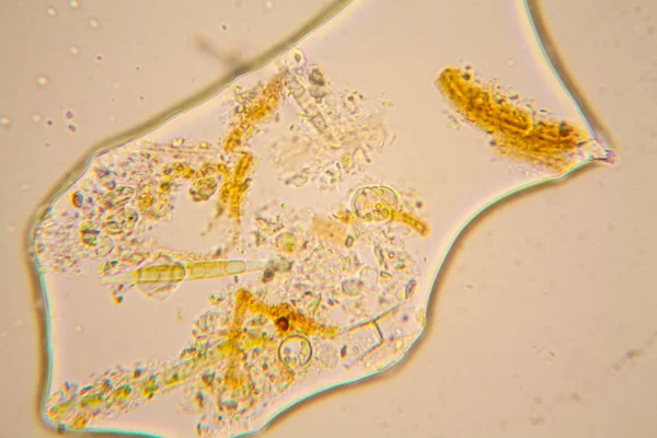 Plancton Acqua Dolce Alghe Microscopio Diatomee — Foto Stock