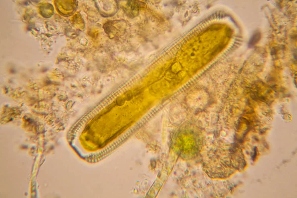 Verse Vijver Water Plankton Algen Microscoop Diatomeeën — Stockfoto