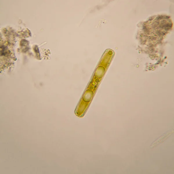 Fresh pond water plankton and algae at the microscope. Diatoms