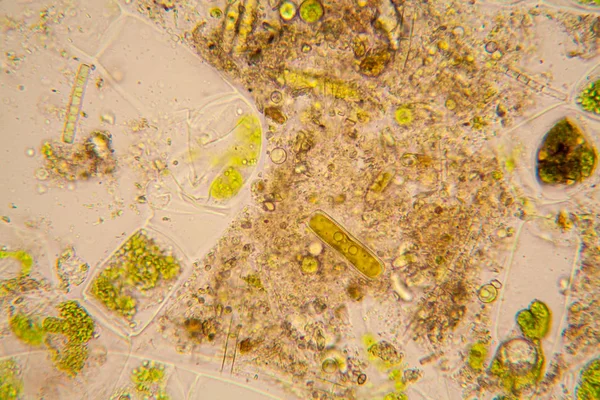 Taze su birikintisi su planktonları ve yosun, mikroskop. Diyatomlarla ve spirogyra