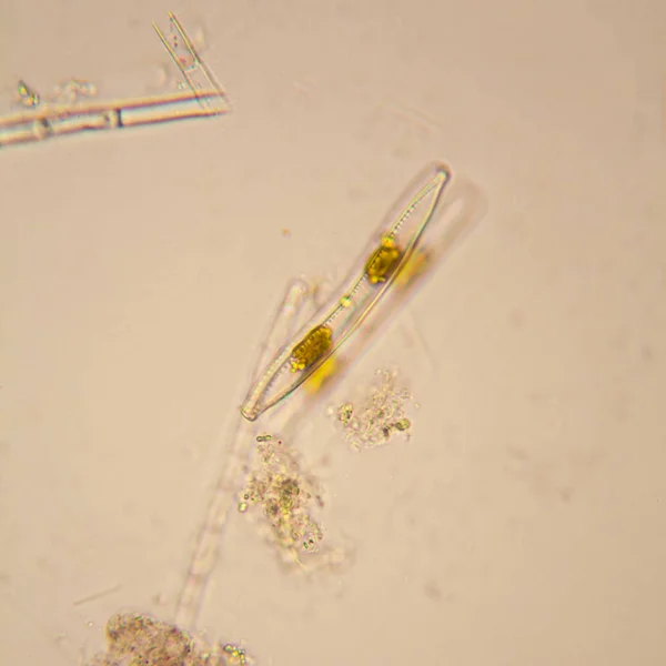 Fresh Pond Water Plankton Algae Microscope Diatoms — Stock Photo, Image