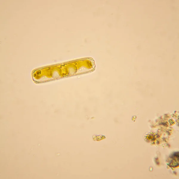 淡水池塘水浮游生物和藻类在显微镜下 — 图库照片