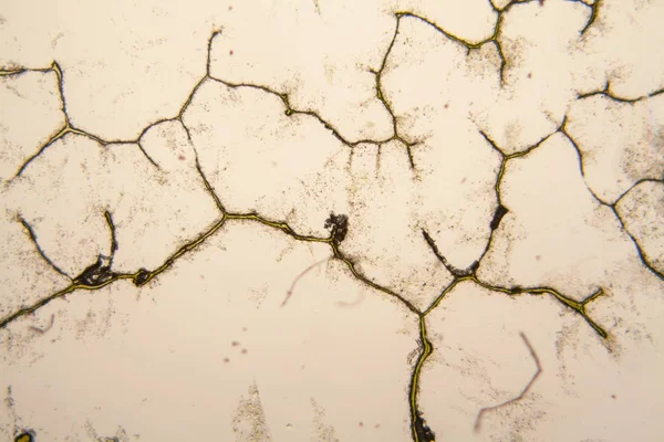 Mikroskobik görünümü ve çürük Lale kök detaylarını 