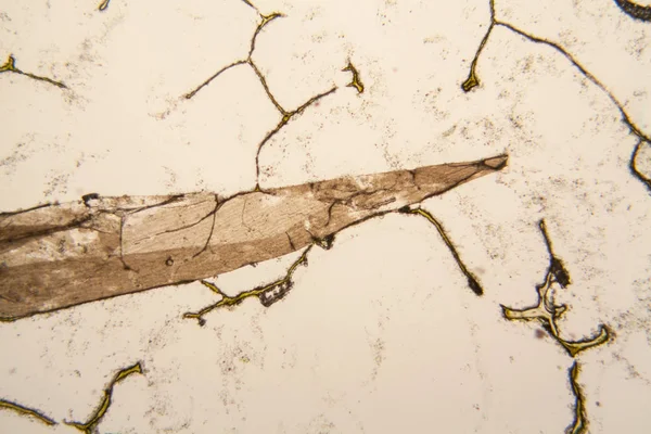 Mikroskobik görünümü ve çürük Lale kök detaylarını 