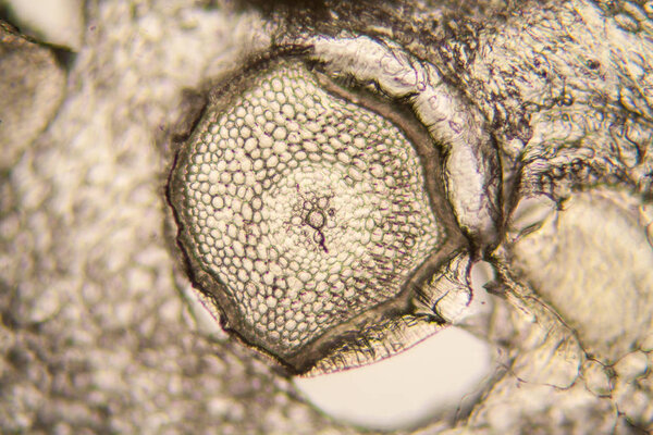 Onion root cells at the microscope 