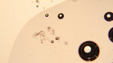 Kabartma tozu ve sirke tepki, mikroskop 