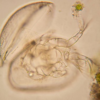 Taze su birikintisi su planktonları ve yosun, mikroskop. Ostracod eklem bacaklılar 
