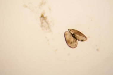 Taze su birikintisi su planktonları ve yosun, mikroskop. Ostracod eklem bacaklılar 