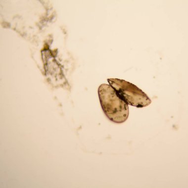 Taze su birikintisi su planktonları ve yosun, mikroskop. Ostracod eklem bacaklılar 