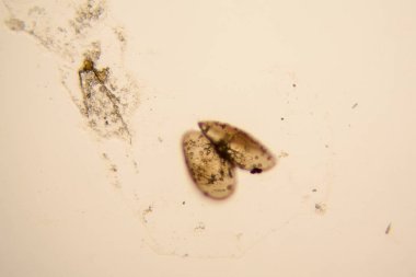 Taze su birikintisi su planktonları ve yosun, mikroskop. Ostracod eklem bacaklılar 