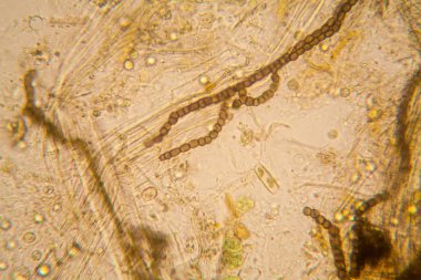 Taze su birikintisi su planktonları ve yosun, mikroskop. Nostoc komün