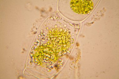 Taze su birikintisi su planktonları ve yosun, mikroskop. Spirogyra