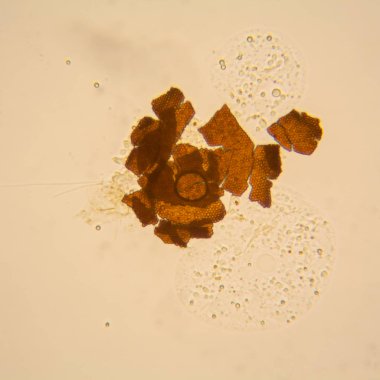 Taze su birikintisi su planktonları ve yosun, mikroskop