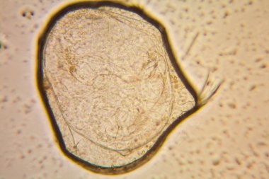 Taze su birikintisi su planktonları ve yosun, mikroskop