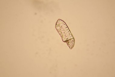 Taze su birikintisi su planktonları ve yosun, mikroskop