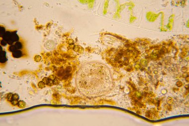 Fresh pond water plankton and algae at the microscope clipart