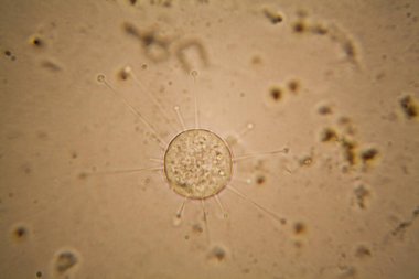 Taze su birikintisi su planktonları ve yosun, mikroskop