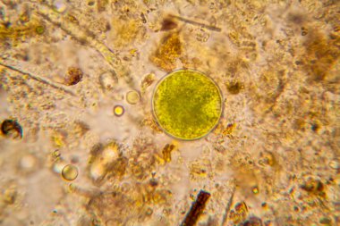 Fresh pond water plankton and algae at the microscope clipart