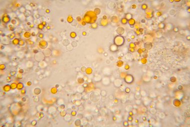 Taze su birikintisi su planktonları ve yosun, mikroskop