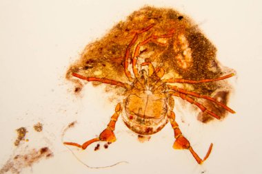 Taze su birikintisi su planktonları ve yosun, mikroskop. Gölet akar