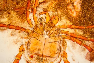 Taze su birikintisi su planktonları ve yosun, mikroskop. Gölet akar