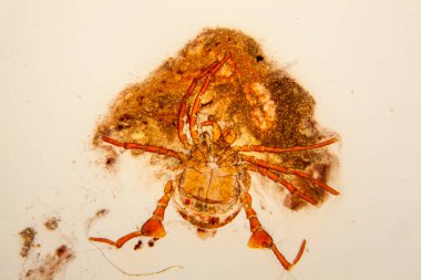 Taze su birikintisi su planktonları ve yosun, mikroskop. Gölet akar