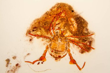 Taze su birikintisi su planktonları ve yosun, mikroskop. Gölet akar