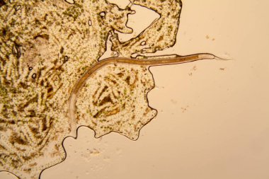 Fresh pond water plankton and algae at the microscope. Nematode clipart