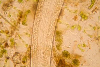 Taze su birikintisi su planktonları ve yosun, mikroskop. Yuvarlak solucanlar