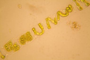 Taze su birikintisi su planktonları ve yosun, mikroskop. Spirogyra
