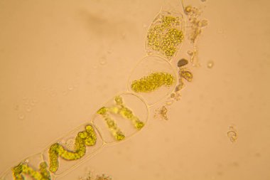 Taze su birikintisi su planktonları ve yosun, mikroskop. Spirogyra