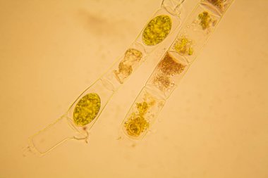 Taze su birikintisi su planktonları ve yosun, mikroskop. Spirogyra
